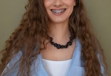 Керамические брекеты на зубы: особенности, преимущества и недостатки