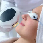 Люмека фотоомоложение: путь к молодости и сиянию кожи