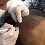 Микропигментация волос: что это такое и зачем нужна