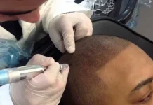 Микропигментация волос: что это такое и зачем нужна