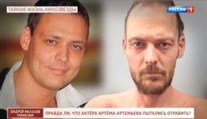 “Выпали все зубы и волосы”: актер Артем Артемьев заявил, что его отравили неизвестные